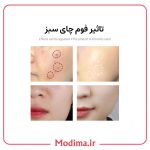 فوم ضد جوش چای سبز هاچانا🌱