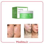 آبرسان ضد جوش چای سبز وان اسپرینگ🌱