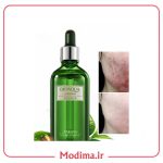 سرم ضد جوش چای سبز بیواکوا🌱