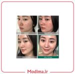 توضیحات پک روتین پوستی ضد جوش 30 روزه