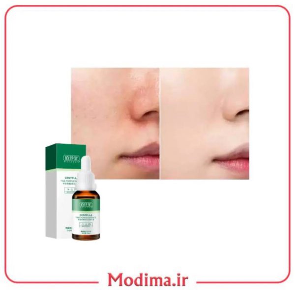 معرفی سرم کوچک کننده منافذ تخصصی سنتلا Centella
