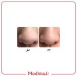ویژگی ماسک بینی ۳ مرحله ای بیواکوا