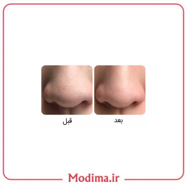ویژگی ماسک بینی ۳ مرحله ای بیواکوا