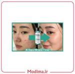 ویژگی پک روتین پوستی ضد جوش 30 روزه