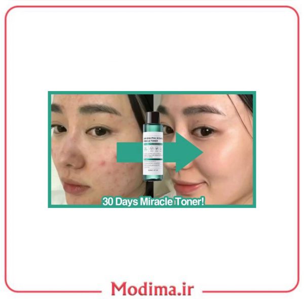 ویژگی پک روتین پوستی ضد جوش 30 روزه