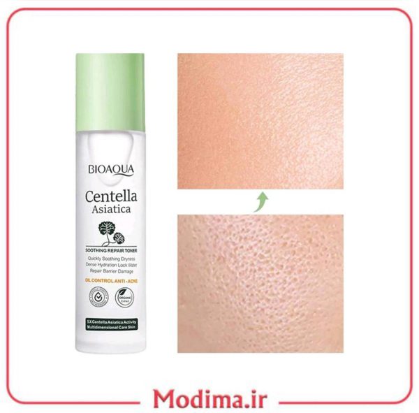 توضیحات تونر ضد جوش سنتلا بیواکوا 120 میل